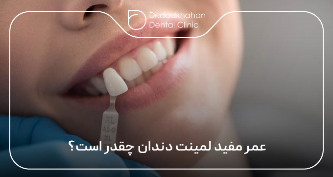 عمر مفید لمینت دندان چقدر است؟