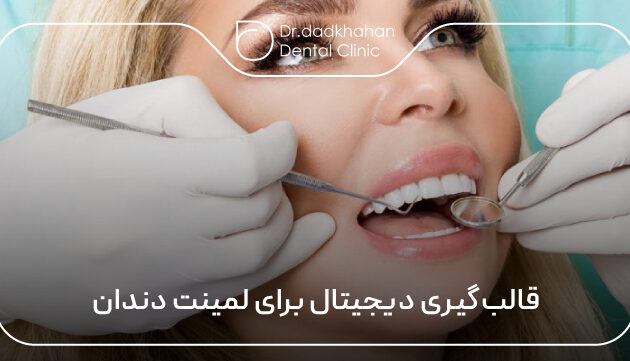 قالب‌گیری دیجیتال برای لمینت دندان