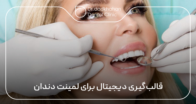 قالب‌گیری دیجیتال برای لمینت دندان