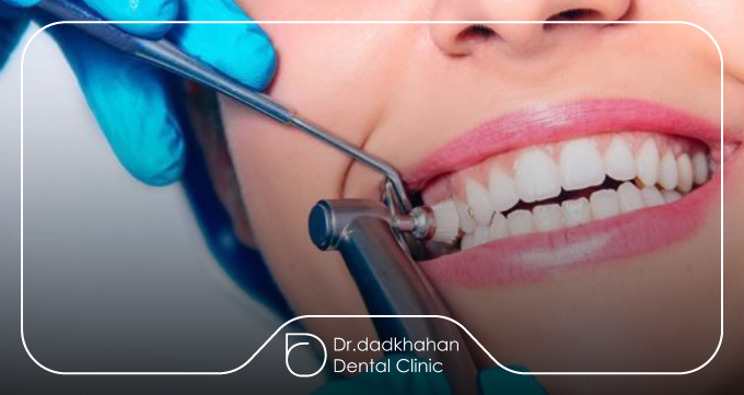 قالب‌گیری دیجیتال چیست؟