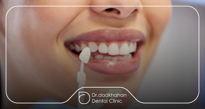 تخصص دندانپزشک و تأثیر آن بر موفقیت لمینت