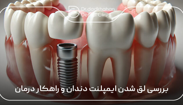 بررسی لق شدن ایمپلنت دندان و راهکار درمان