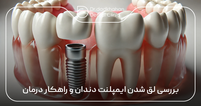 بررسی لق شدن ایمپلنت دندان و راهکار درمان