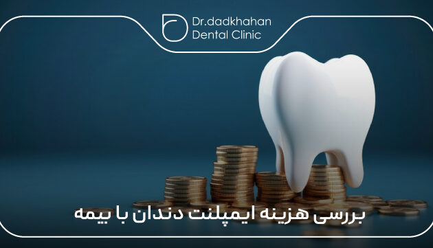بررسی هزینه ایمپلنت دندان با بیمه