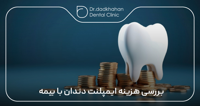 بررسی هزینه ایمپلنت دندان با بیمه