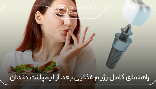 راهنمای کامل رژیم غذایی بعد از ایمپلنت دندان