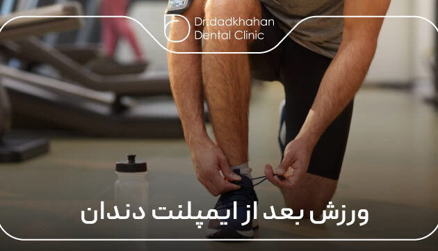 ورزش بعد از ایمپلنت دندان