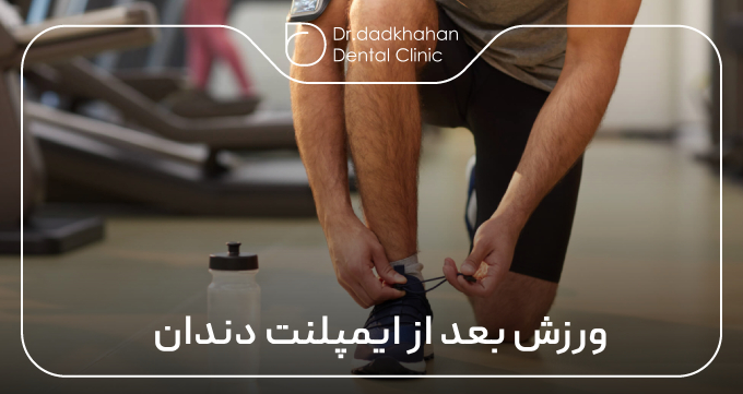ورزش بعد از ایمپلنت دندان