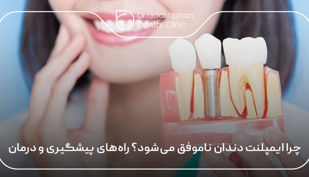 چرا ایمپلنت دندان ناموفق می‌شود؟ راه‌های پیشگیری و درمان 