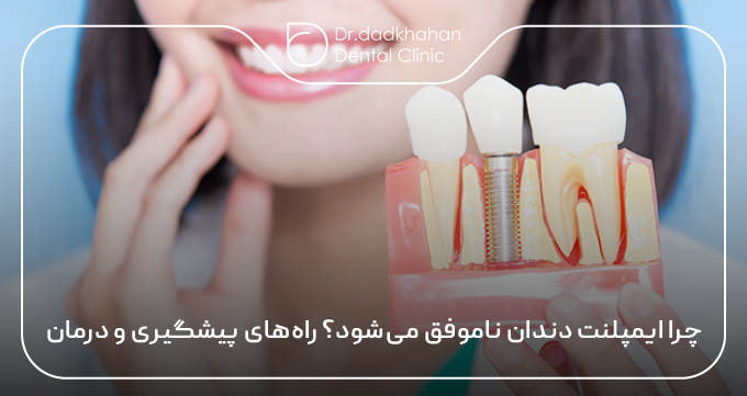 چرا ایمپلنت دندان ناموفق می‌شود؟ راه‌های پیشگیری و درمان 