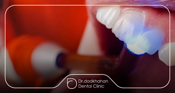 کامپوزیت سوئیسی