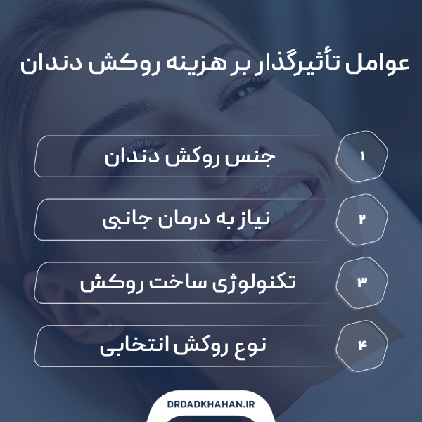 قیمت کامپوزیت و روکش – سال ۱۴۰۴