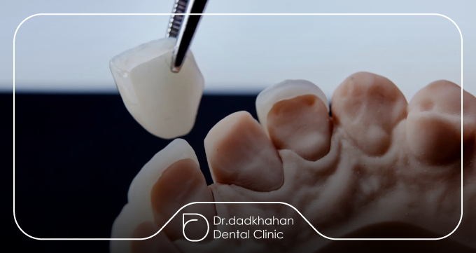 معرفی برند و ویژگیهای فنی