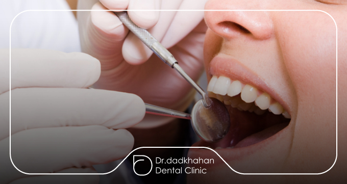 تعریف کامپوزیت و آمالگام