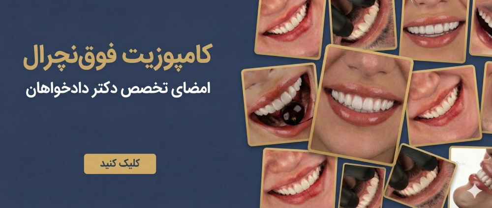 معیارهای انتخاب بهترین کامپوزیت