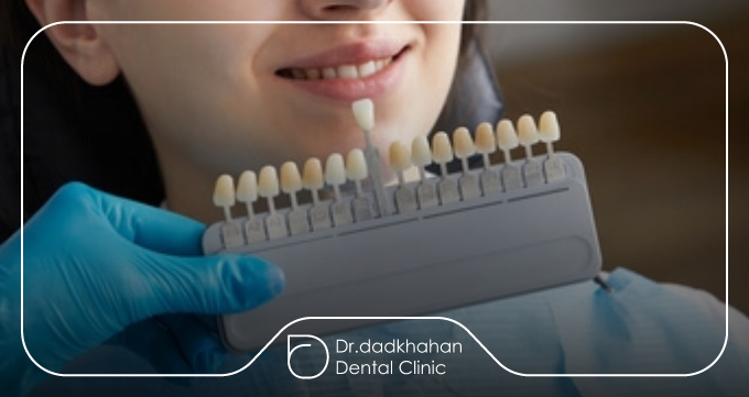 اشتباه رایج: یکی دانستن لمینت با پوسیدگی دندان