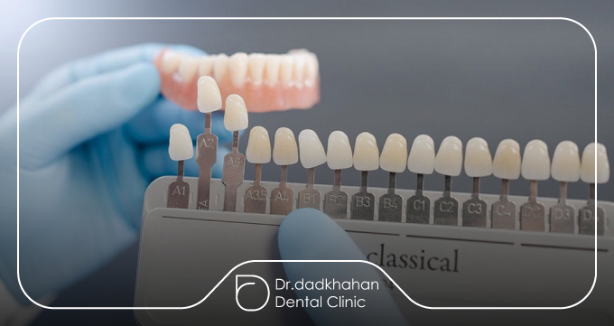 ساختار و مواد لمینت کریستالی