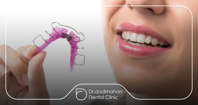 انواع ارتودنسی متحرک؛ کدام مدل مناسب شما است؟