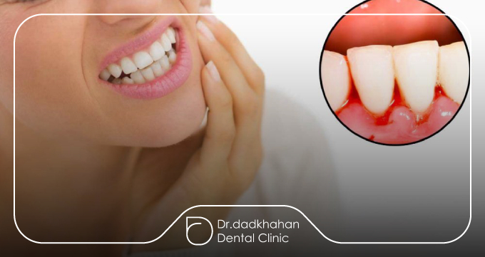 لثههای قرمز، متورم یا دردناک